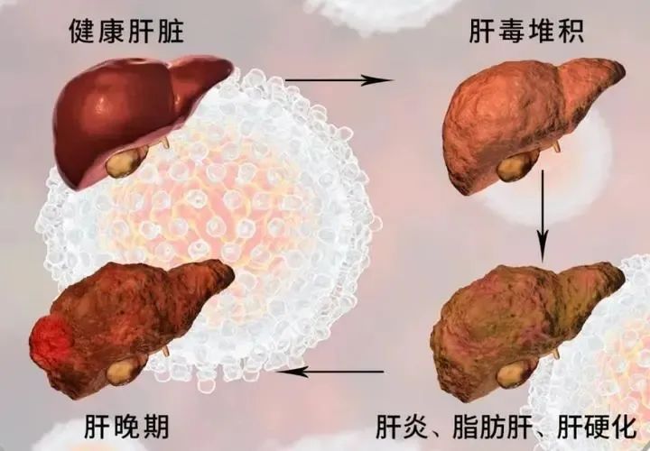 酵素代加工工厂|场景化精准营销,掘金万亿解酒市场 酵素代加工工厂|场景化精准营销,掘金万亿解酒市场