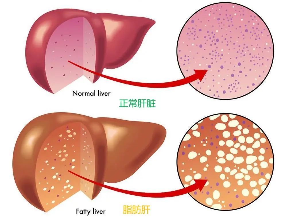 酵素加工厂|千古解酒护肝第一方!药食同源枳椇子 酵素加工厂|千古解酒护肝第一方!药食同源枳椇子
